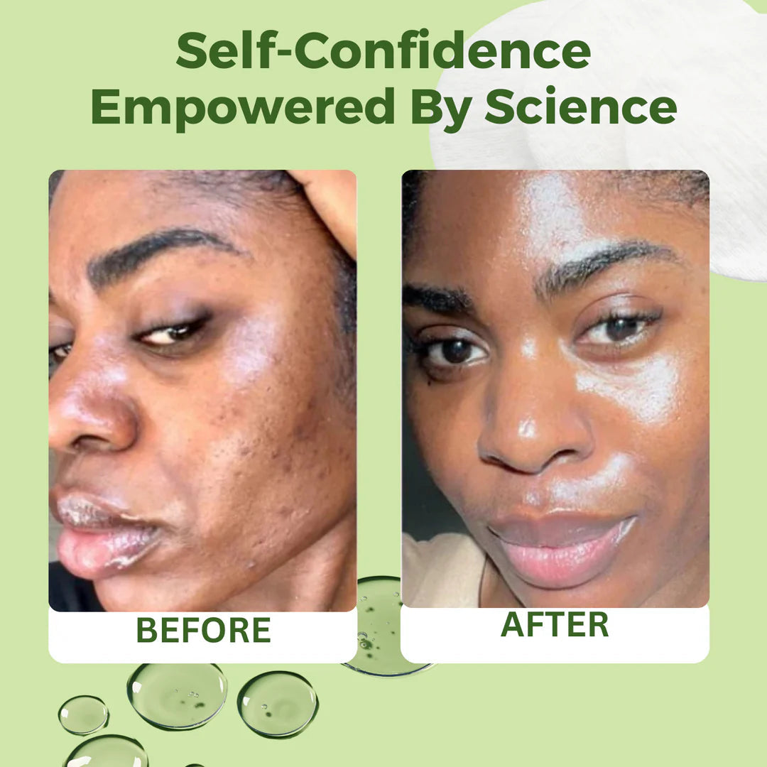 JiYu Korean Skincare Toner Pads for Anti-aging – 100 ct