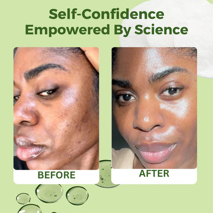 JiYu Korean Skincare Toner Pads for Anti-aging – 100 ct